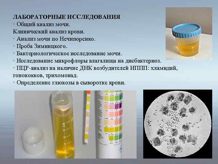 ЛАБОРАТОРНЫЕ ИССЛЕДОВАНИЯ · Общий анализ мочи. Клинический анализ крови. · Анализ мочи по Нечипоренко.