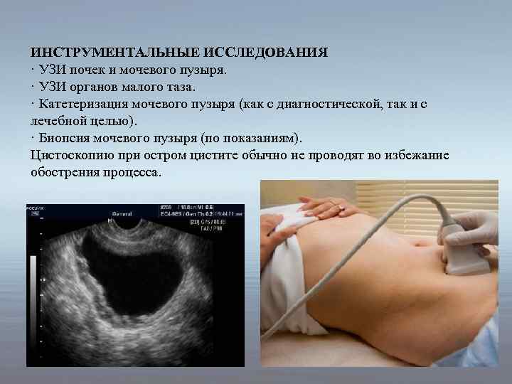 ИНСТРУМЕНТАЛЬНЫЕ ИССЛЕДОВАНИЯ · УЗИ почек и мочевого пузыря. · УЗИ органов малого таза. ·