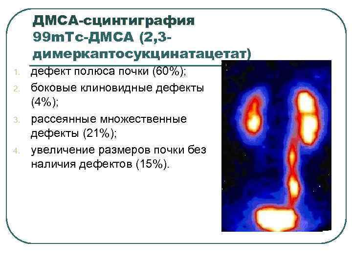 Что такое сцинтиграфия