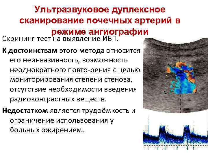 Дуплексное сканирование сосудов почек