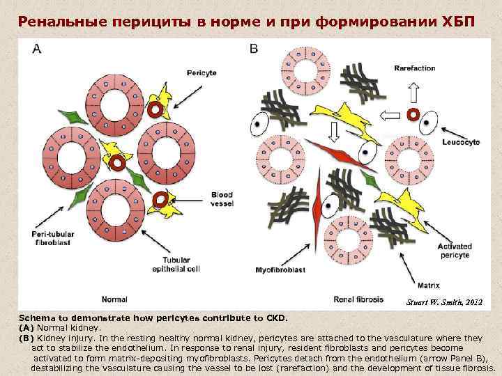 Ренальные перициты в норме и при формировании ХБП Stuart W. Smith, 2012 Schema to