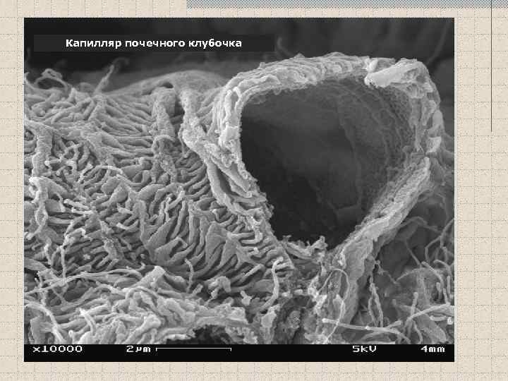 Капилляр почечного клубочка 