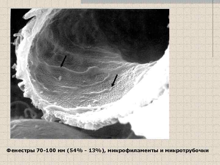 Фенестры 70 -100 нм (54% - 13%), микрофиламенты и микротрубочки 