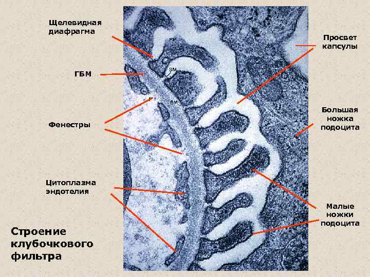 Щелевидная диафрагма Просвет капсулы ГБМ Фенестры Большая ножка подоцита Цитоплазма эндотелия Строение клубочкового фильтра