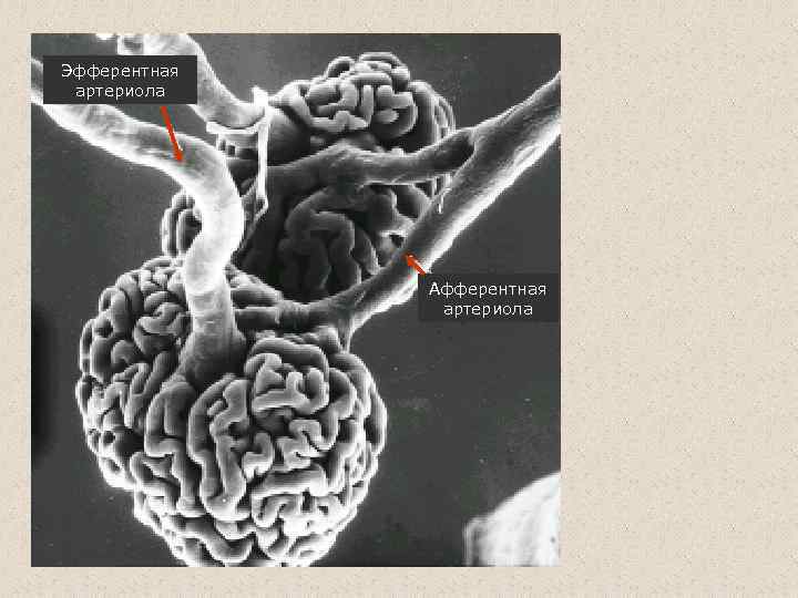 Эфферентная артериола Афферентная артериола 