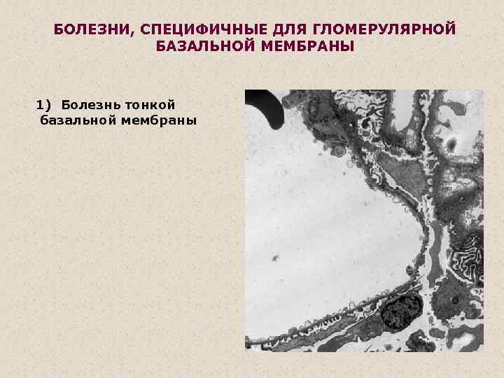 В расщеплении базальной мембраны стенки капилляров располагаются