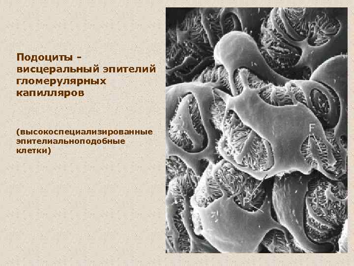 Подоциты висцеральный эпителий гломерулярных капилляров (высокоспециализированные эпителиальноподобные клетки) 