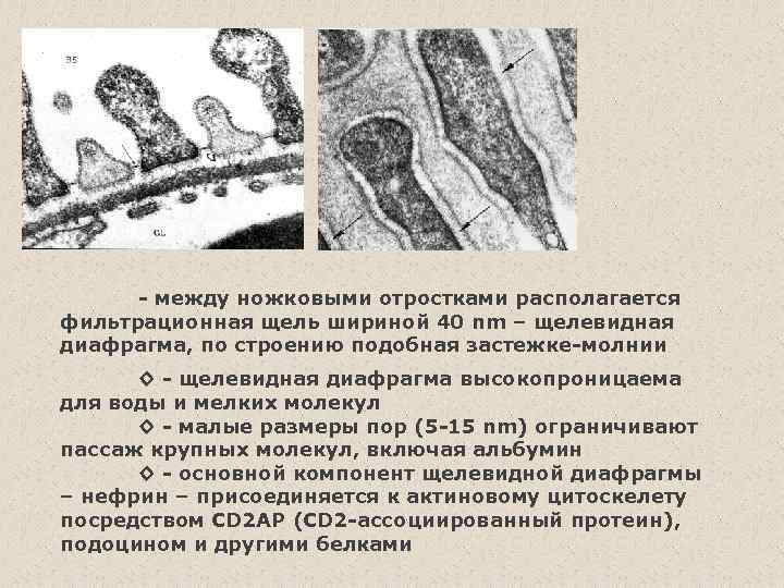 - между ножковыми отростками располагается фильтрационная щель шириной 40 nm – щелевидная диафрагма, по
