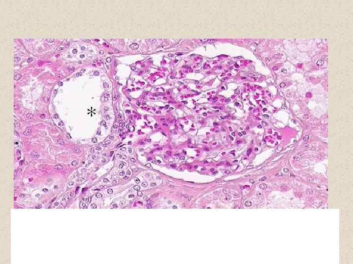 The asterisk marks the macula densa in the kidney. The macula densa is a
