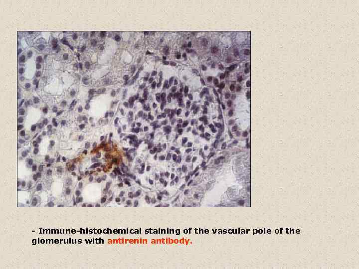- Immune-histochemical staining of the vascular pole of the glomerulus with antirenin antibody. 