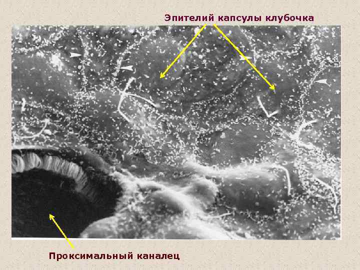 Эпителий капсулы клубочка Проксимальный каналец 
