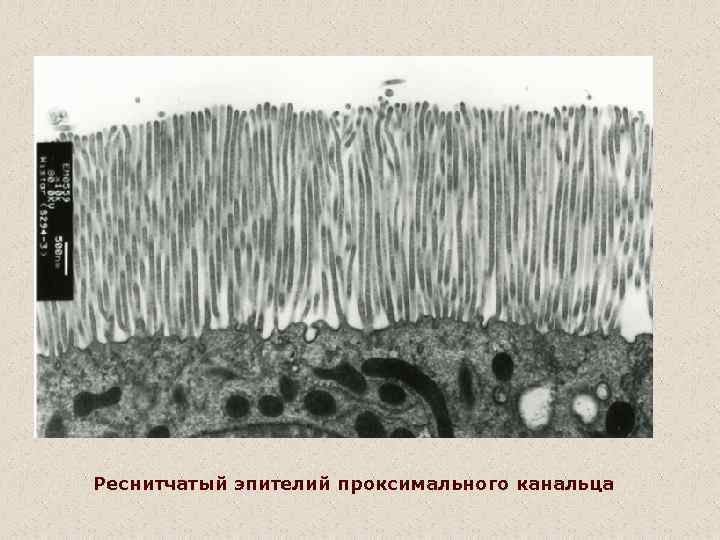 Реснитчатый эпителий проксимального канальца 