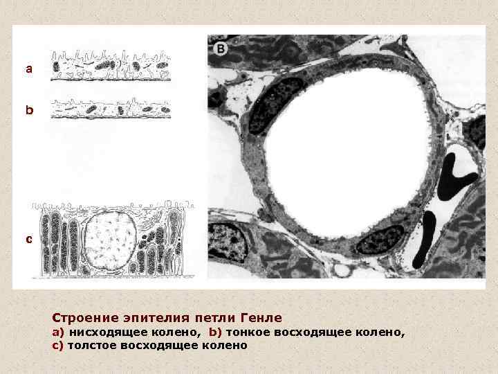 a b c Строение эпителия петли Генле a) нисходящее колено, b) тонкое восходящее колено,