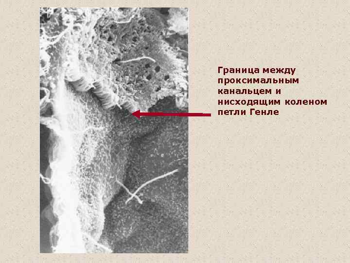 Граница между проксимальным канальцем и нисходящим коленом петли Генле 
