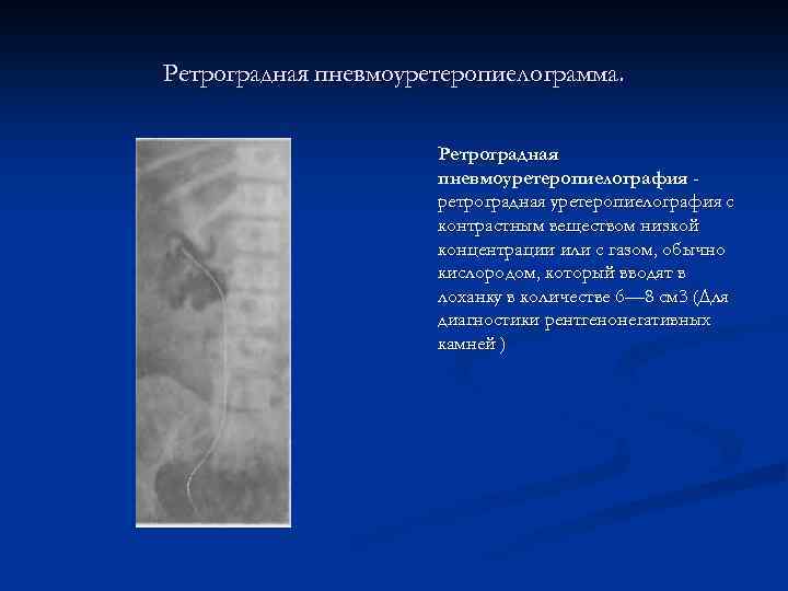 Ретроградная пневмоуретеропиелограмма. Ретроградная пневмоуретеропиелография ретроградная уретеропиелография с контрастным веществом низкой концентрации или с газом,
