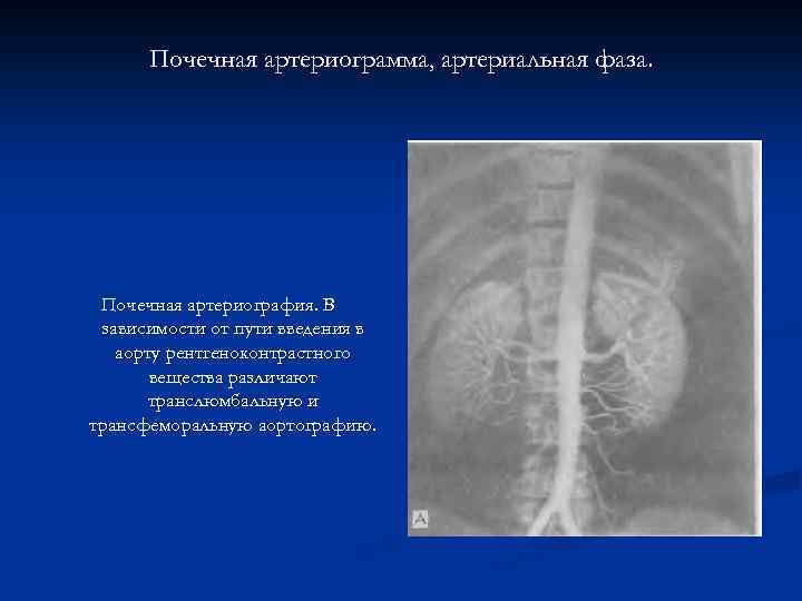 Почечная артериограмма, артериальная фаза. Почечная артериография. В зависимости от пути введения в аорту рентгеноконтрастного