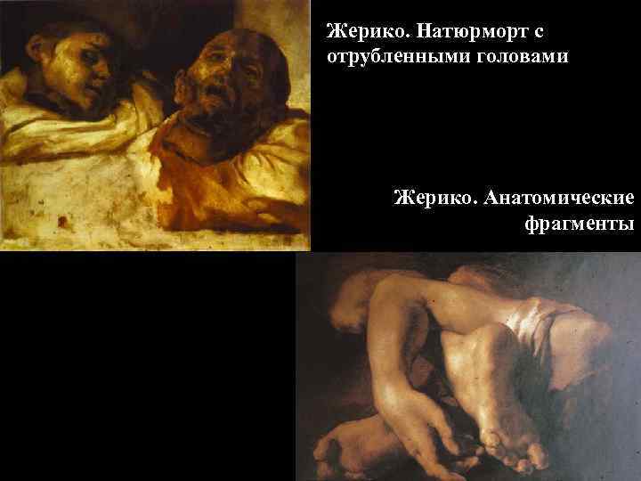 Жерико. Натюрморт с отрубленными головами Жерико. Анатомические фрагменты 