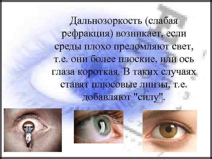 Дальнозоркость (слабая рефракция) возникает, если среды плохо преломляют свет, т. е. они более плоские,