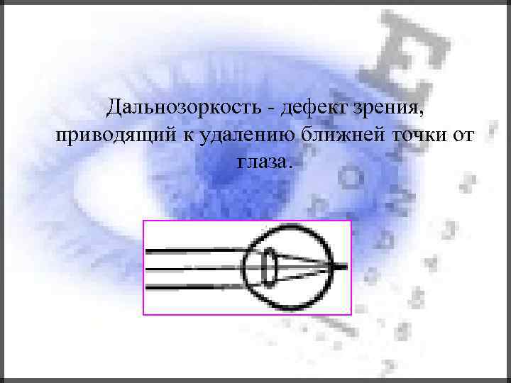 Дальнозоркость - дефект зрения, приводящий к удалению ближней точки от глаза. 