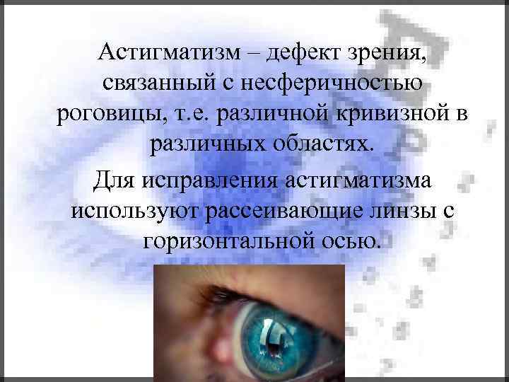 Астигматизм – дефект зрения, связанный с несферичностью роговицы, т. е. различной кривизной в различных