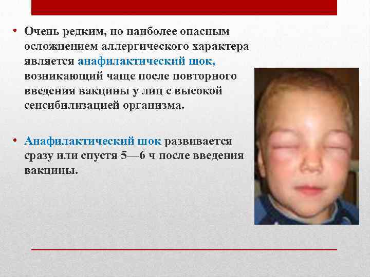  • Очень редким, но наиболее опасным осложнением аллергического характера является анафилактический шок, возникающий