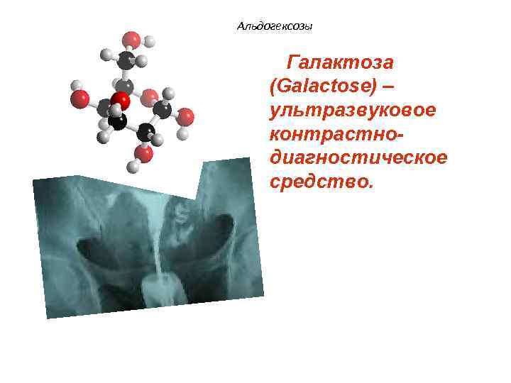 Альдогексозы Галактоза (Galactose) – ультразвуковое контрастнодиагностическое средство. 
