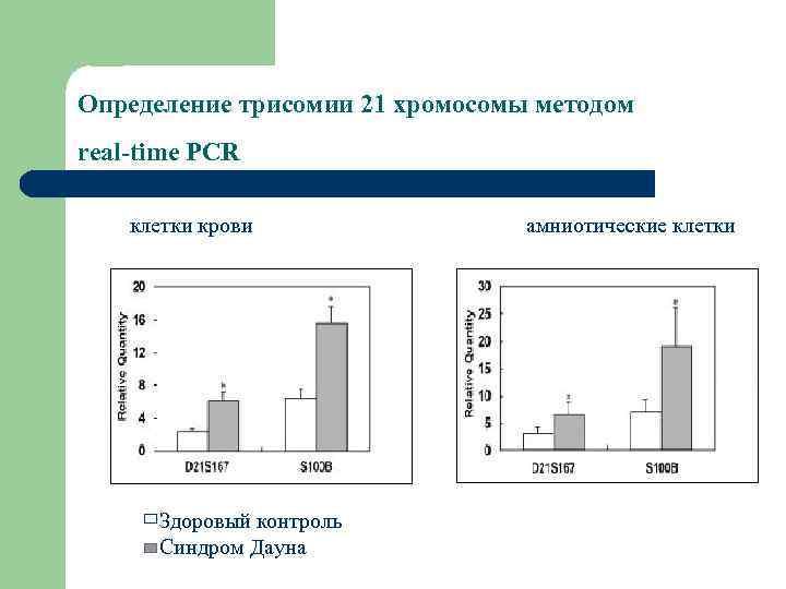 Определение трисомии 21 хромосомы методом real-time PCR клетки крови Здоровый контроль Синдром Дауна амниотические