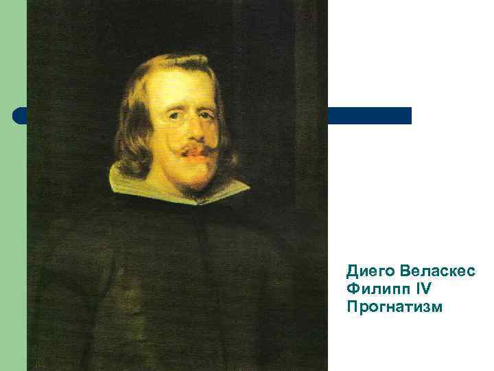 Диего Веласкес Филипп IV Прогнатизм 