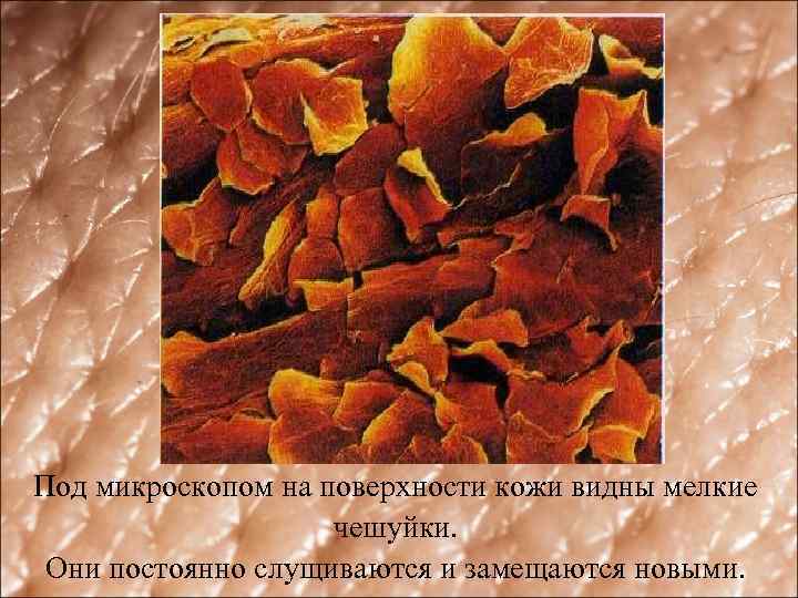 Под микроскопом на поверхности кожи видны мелкие чешуйки. Они постоянно слущиваются и замещаются новыми.