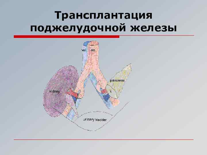Пересадка поджелудочной железы при сахарном диабете. Трансплантация поджелудочной железы. Трансплантация поджелудочной железы показания. Трансплантация поджелудочной железы презентация. Трансплантация поджелудочной железы в России.