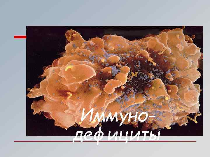 Иммунодефициты 