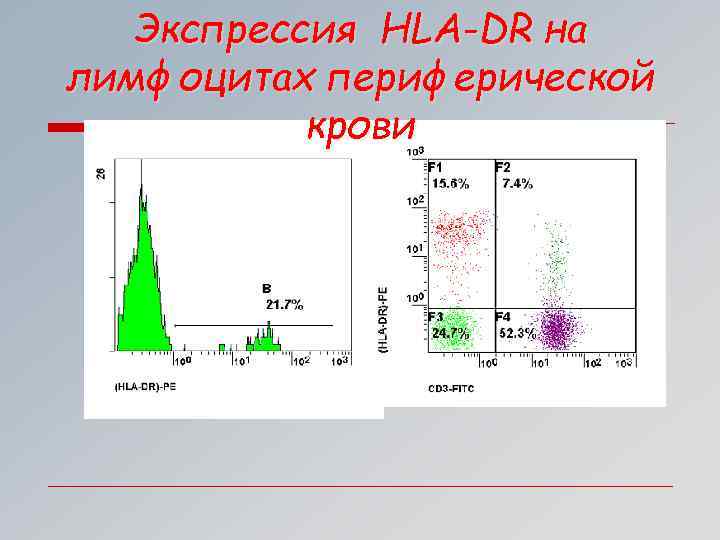Экспрессия HLA-DR на лимфоцитах периферической крови 