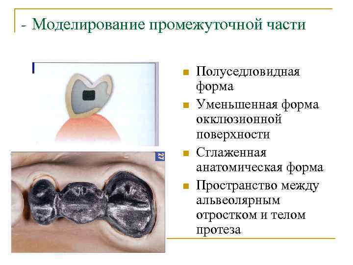 - Моделирование промежуточной части n n Полуседловидная форма Уменьшенная форма окклюзионной поверхности Сглаженная анатомическая