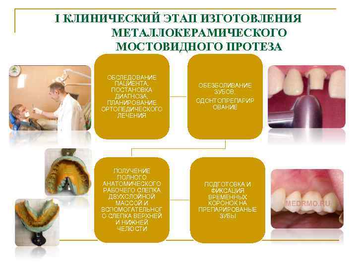 I КЛИНИЧЕСКИЙ ЭТАП ИЗГОТОВЛЕНИЯ МЕТАЛЛОКЕРАМИЧЕСКОГО МОСТОВИДНОГО ПРОТЕЗА ОБСЛЕДОВАНИЕ ПАЦИЕНТА, ПОСТАНОВКА ДИАГНОЗА, ПЛАНИРОВАНИЕ ОРТОПЕДИЧЕСКОГО ЛЕЧЕНИЯ