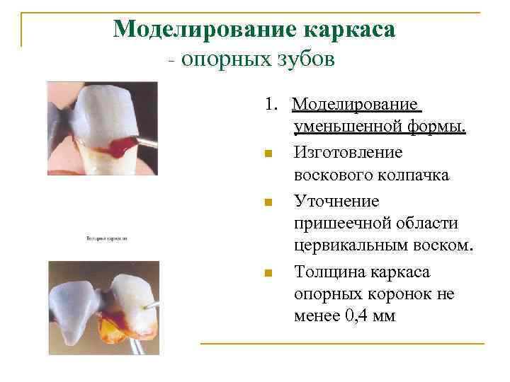 Моделирование каркаса - опорных зубов 1. Моделирование уменьшенной формы. n Изготовление воскового колпачка n