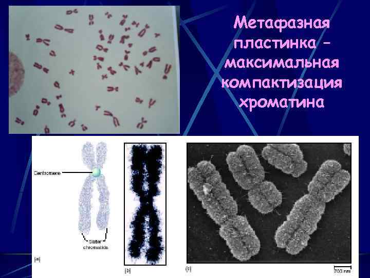 Метафазная пластинка – максимальная компактизация хроматина 