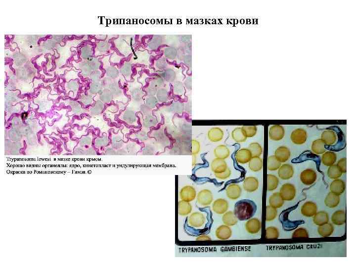 Медицинская протозоология презентация