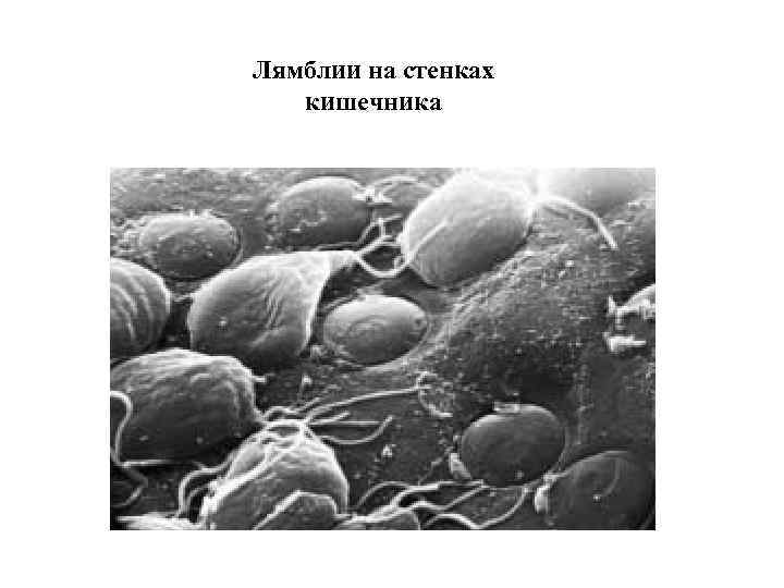 Лямблии на стенках Микрофотография лямблий, паразитирующих в слизистой 12 кишечника -перстной кишки 