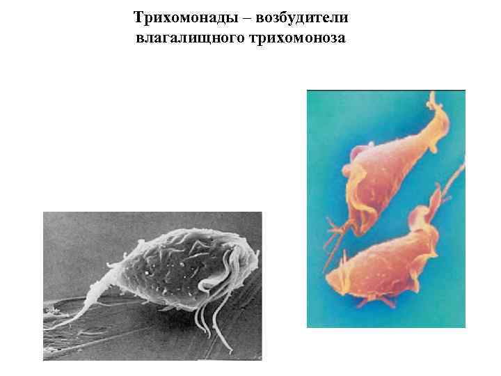 Трихомонады – возбудители влагалищного трихомоноза 