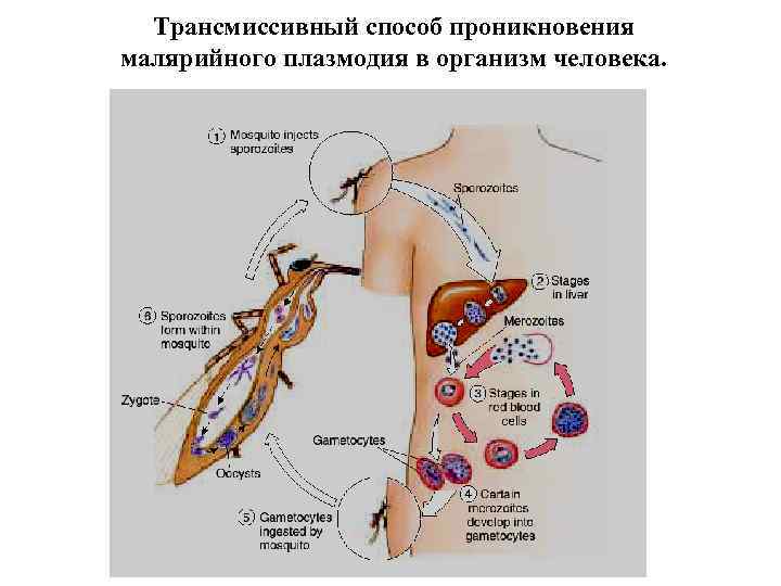 Трансмиссивный способ проникновения малярийного плазмодия в организм человека. 