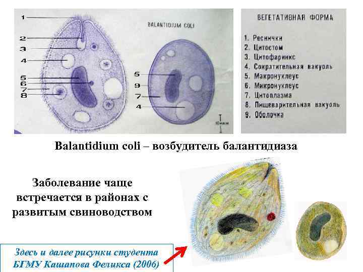 Balantidium coli – возбудитель балантидиаза Заболевание чаще встречается в районах с развитым свиноводством Здесь