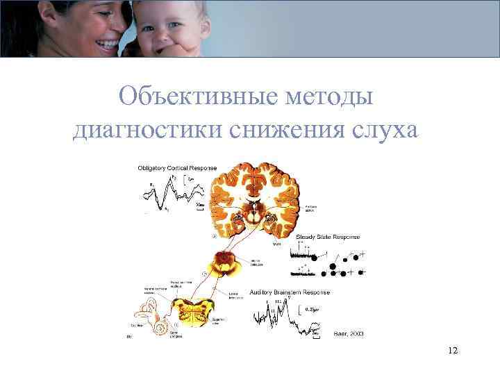 Объективные методы диагностики снижения слуха 12 