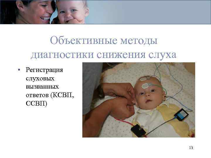 Объективные методы диагностики снижения слуха • Регистрация слуховых вызванных ответов (КСВП, ССВП) 13 