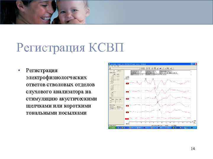 Регистрация КСВП • Регистрация электрофизиологческих ответов стволовых отделов слухового анализатора на стимуляцию акустическими щелчками