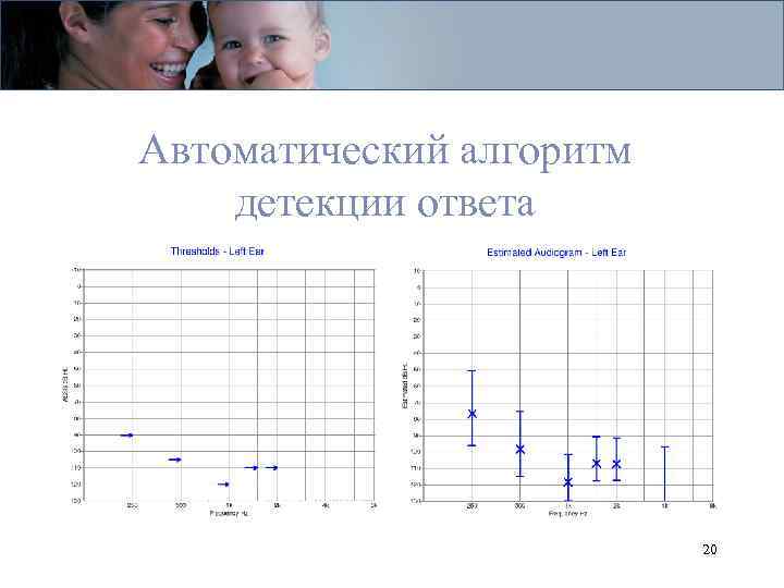 Автоматический алгоритм детекции ответа 20 