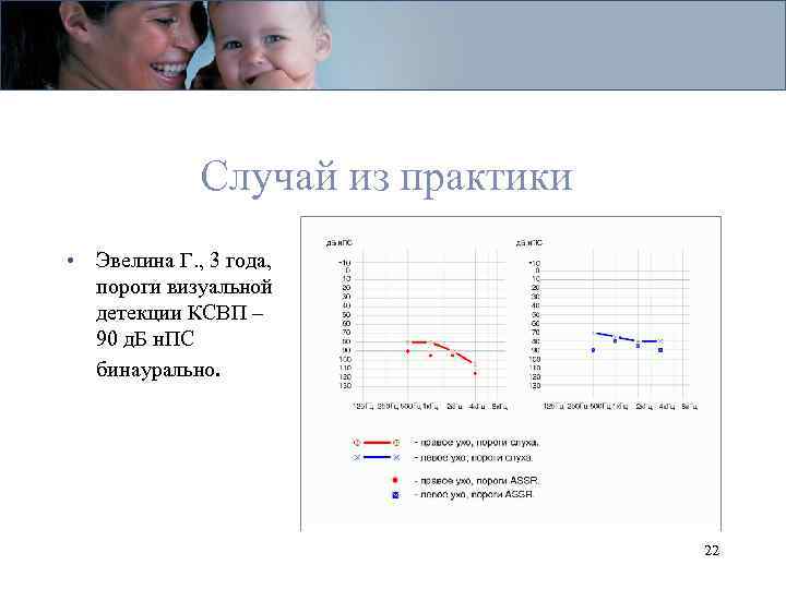 Случай из практики • Эвелина Г. , 3 года, пороги визуальной детекции КСВП –