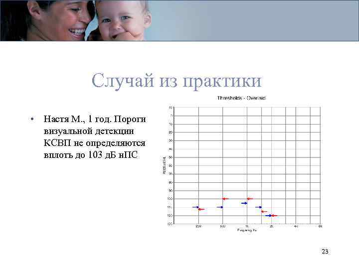 Случай из практики • Настя М. , 1 год. Пороги визуальной детекции КСВП не