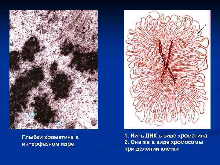 Глыбки хроматина в интерфазном ядре 1. Нить ДНК в виде хроматина. 2. Она же