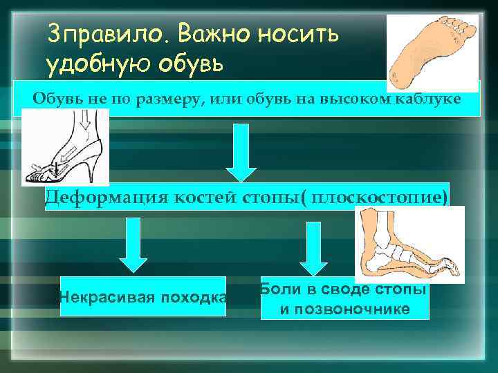 3 правило. Важно носить удобную обувь Обувь не по размеру, или обувь на высоком