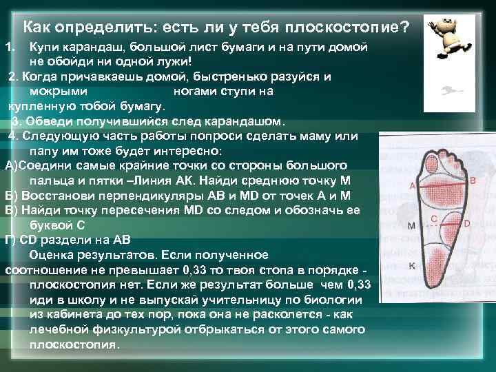 Как определить: есть ли у тебя плоскостопие? 1. Купи карандаш, большой лист бумаги и